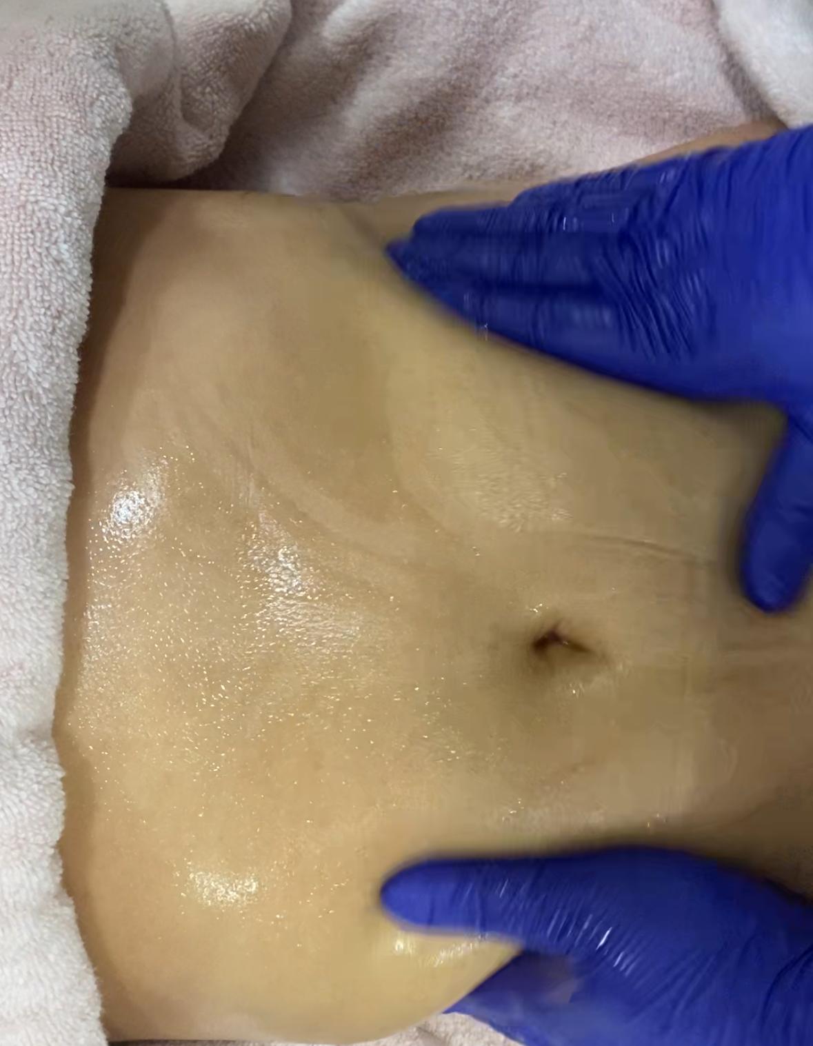 Maderoterapia - Terapia de Retouche — imagen 1